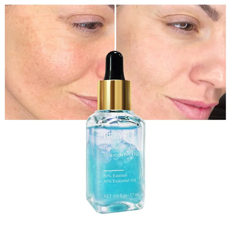 17ml Hyaluronic Acid Rose Essential Oil Moisturizer Whitening Essence Face Skin Care Rose Orange