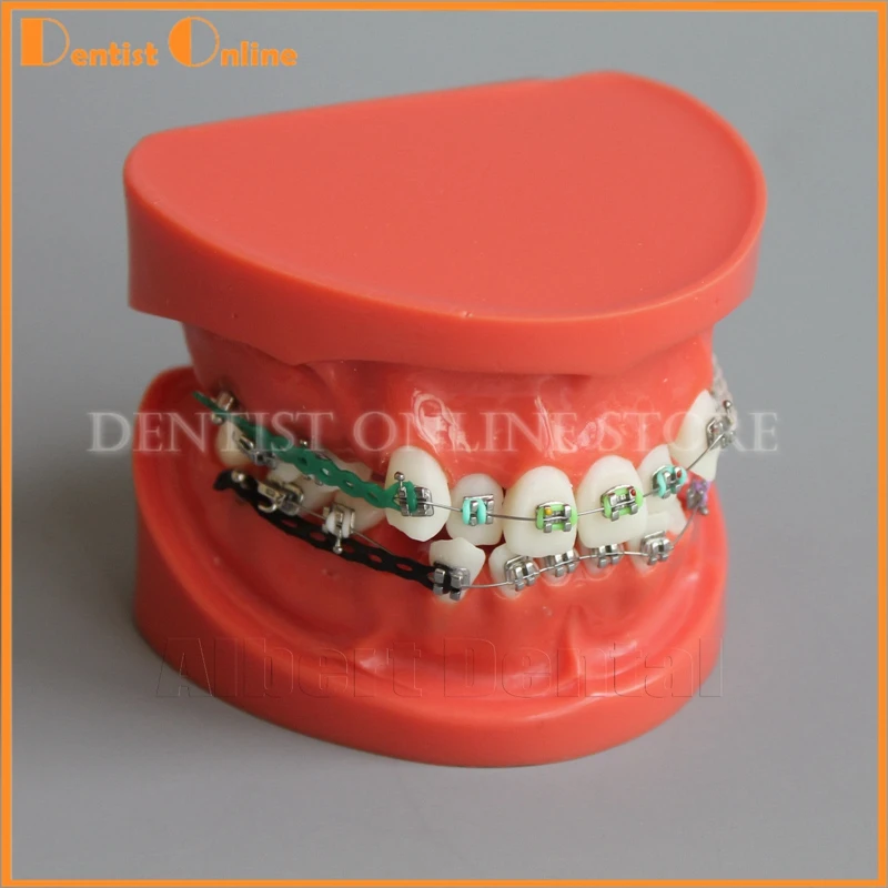 Dental Orthodontics Model Study Bracket Arch Wire Chain Teeth Typodont