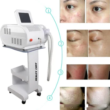 

2019 New professional ipl elight shr machine diode laser permanent hair removal portable hair removal diode laser equipment