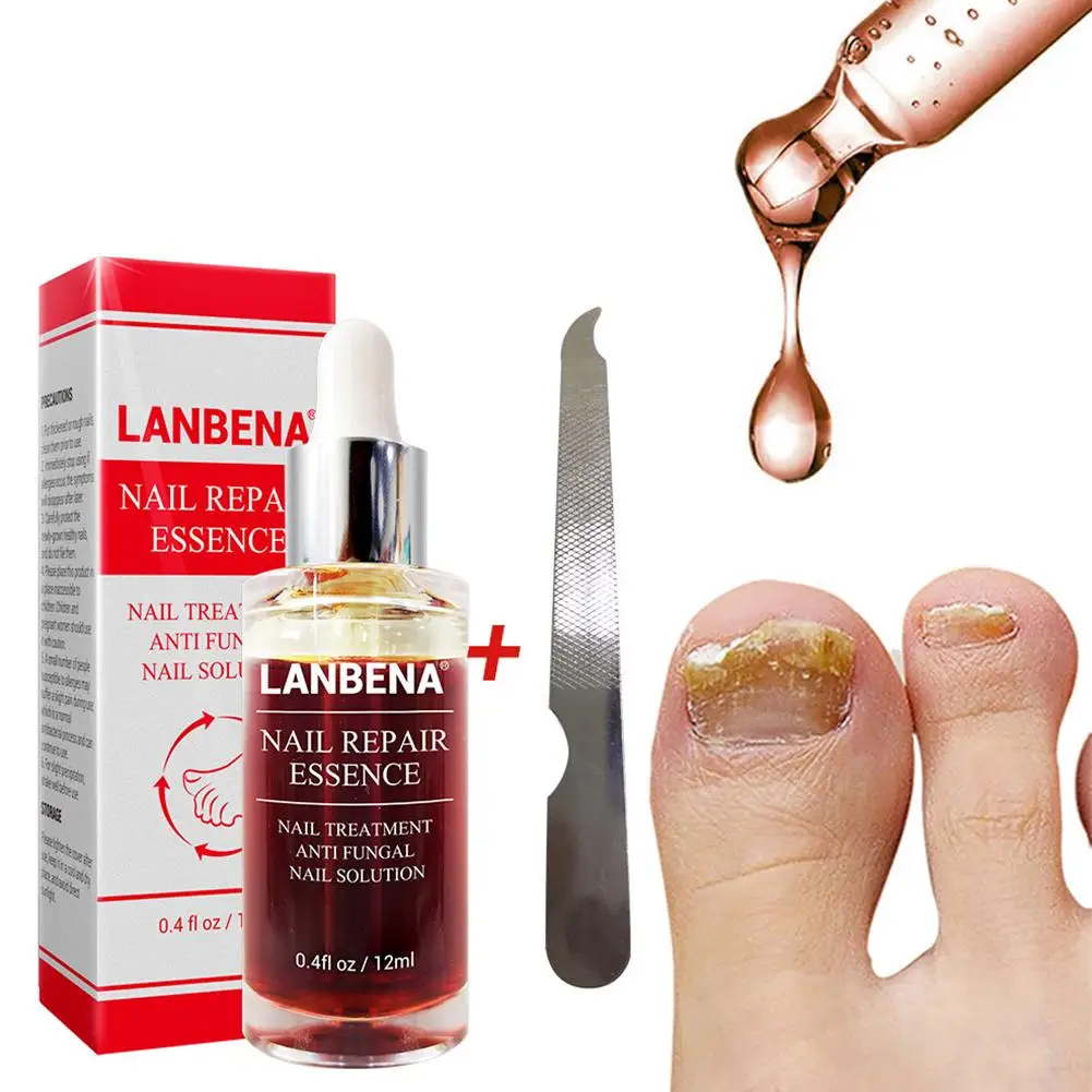 

LANBENA Nail Repair Essence Serum Fungal Nail Treatment Remove Onychomycosis Toe Nourishing Brighten Hand Foot Skin Care 12ml