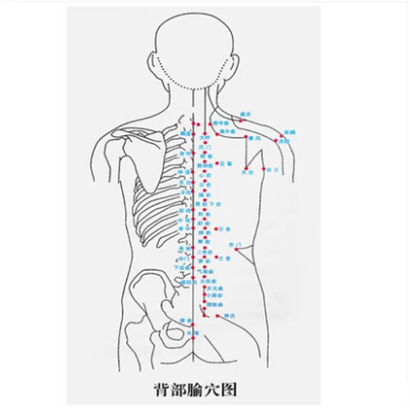 Схема постановки банок. Схема постановки вакуумных банок. Вакуумные банки схема постановки. Схема постановки вакуумных банок на спину. Вакуумно магнитные банки схема постановки.