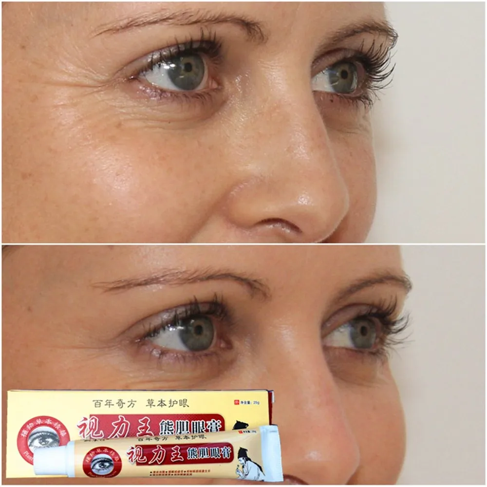 eye wrinkle repair