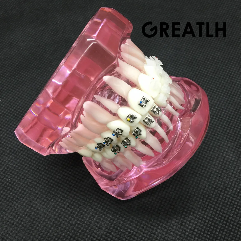 

Dental Orthodontic Model with Metal and Ceramic Brackets 3003 Pink Dental Teeth Study Model