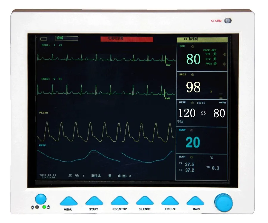 

FDA&CE CMS8000 ICU CCU Patient Monitor 6 Parameters MultiParameter Vital Sign ECG NIBP RESP TEMP SPO2 PR
