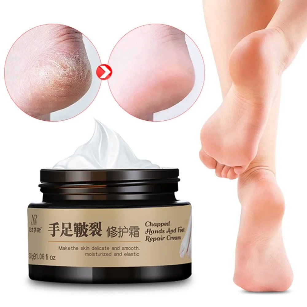 Moisturising Repair Cream 30G Portable Nourish Hand & Foot Crack Cream Heel Peeling Foot Hand Repair Chapping Treatment Cream 