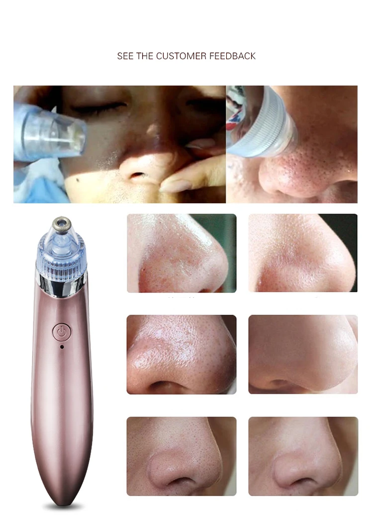 Pore Cleaner Blackhead Remover Vacuum Electric Nose Face Black Dot Dermabrasion Deep Cleansing Skin Care Machine Beauty Tool