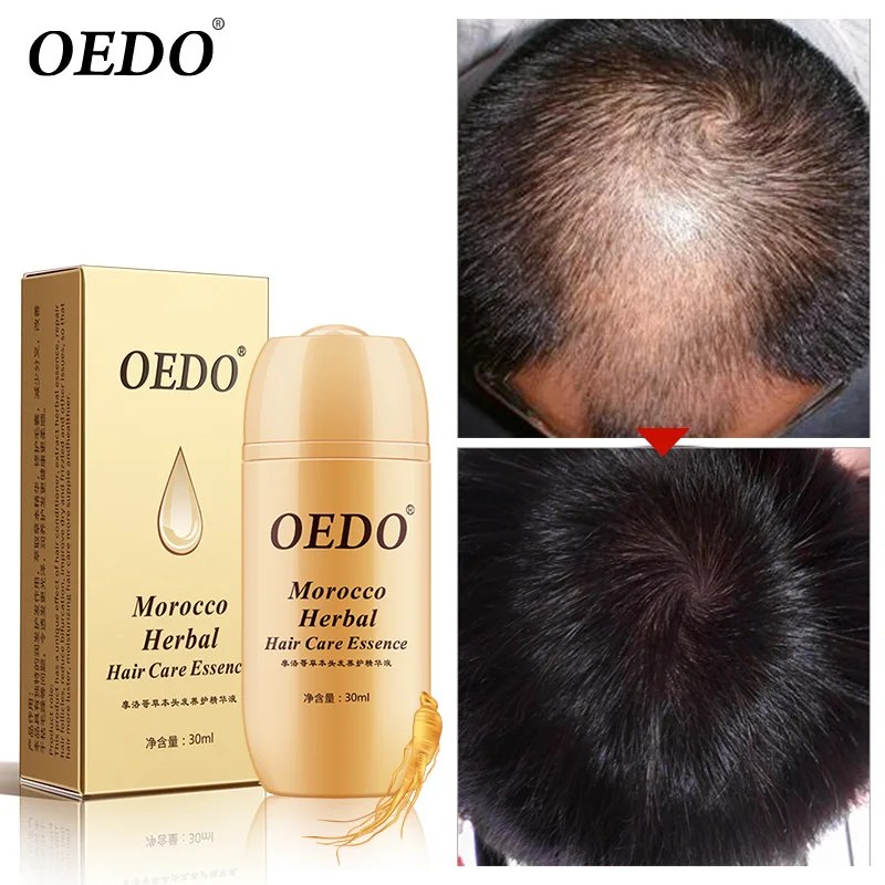 Hair Care Essence Treatment of Hair Loss Repair Hair ...