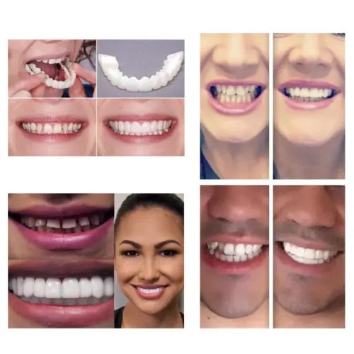 Удобные кнопки на Для мужчин Для женщин зуб мгновенное идеальной улыбка отбеливание улыбка зубы крышка подходит Flex зубы подходит зубной