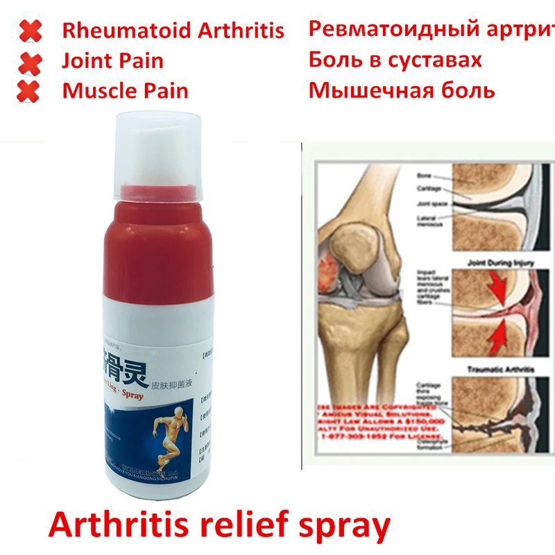 relief pain spray analgesic spray Arthritis spray Penetrates deep into