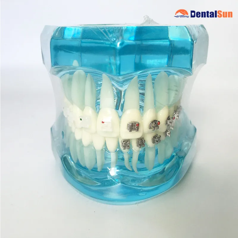 

Dental Orthodontic Demonstration Teeth Model with Ceramic Brackets and Metal Brackets M3003