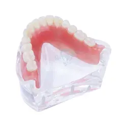 Зубные обучения, изучения Overdenture Зубы Модель съемный интерьер нижние челюсти модель