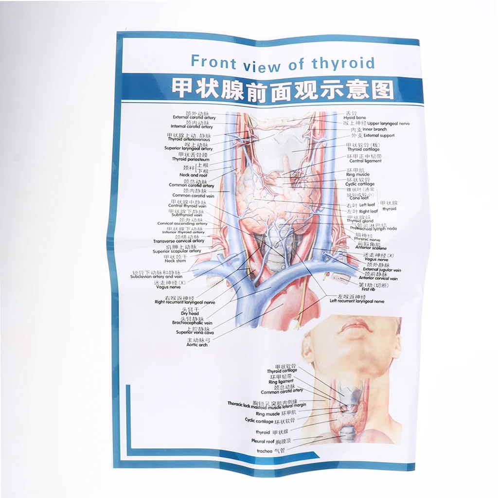 Magnified Human Thyroid Anatomical Model Normal & Diseased With Pathologies For Classroom Study Display Teaching
