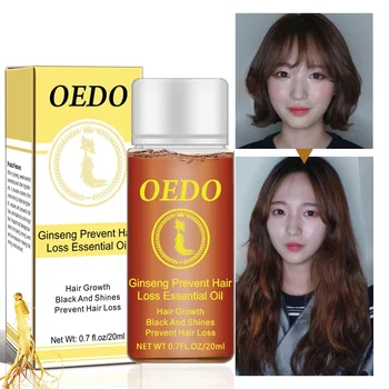 

20ML Ginseng Hair Growth Essence Preventing Hair Loss Liquid Damage Hair Repair Treatment Dense Fast Restoration TSLM1