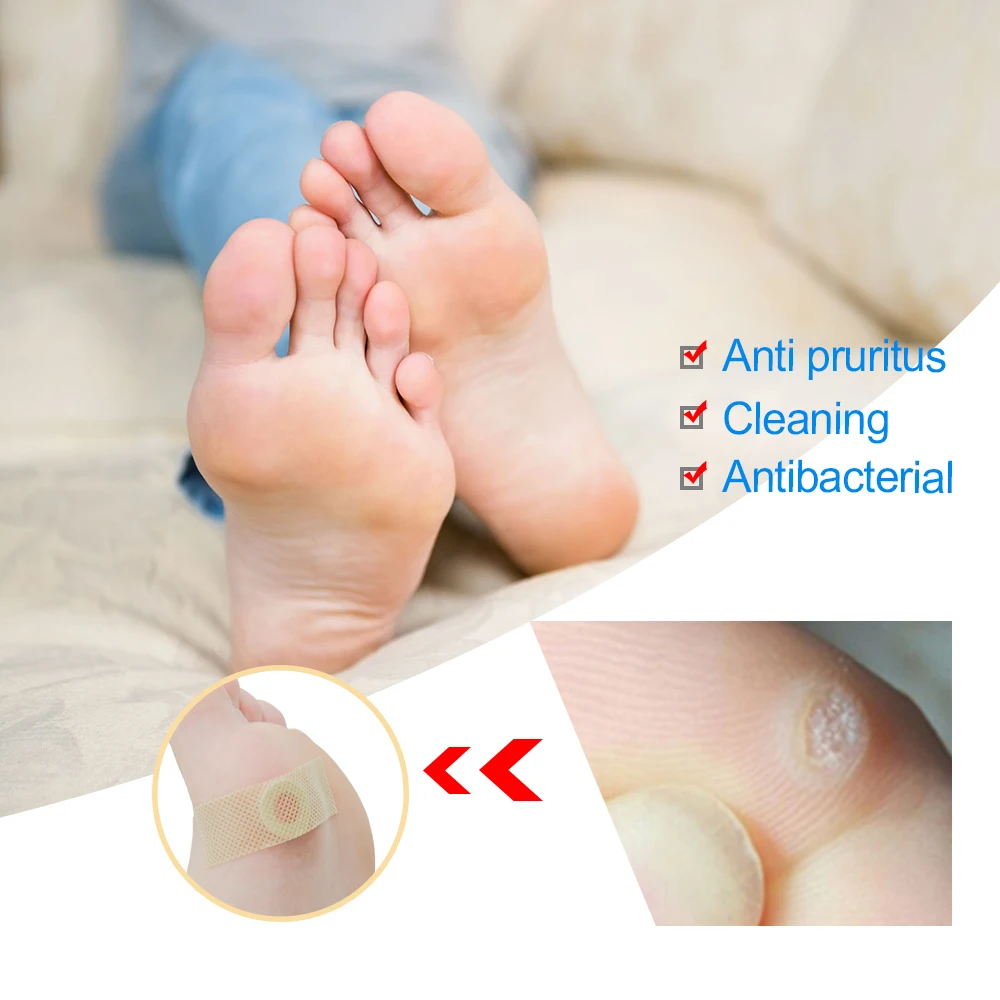 Sumifun 42Pcs Box Foot Corn Removal Plaster Warts Thorn Feet Callus Remove Soften Skin Cutin Sticker 1 Sumifun 42Pcs Box Foot Corn Removal Plaster Warts Thorn Feet Callus Remove Soften Skin Cutin Sticker 5