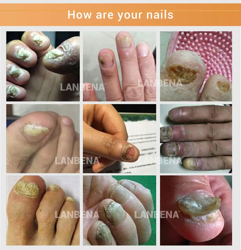 nail-repair-essence-2_01