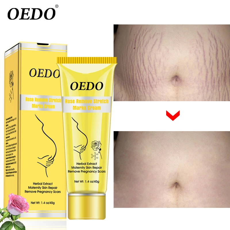 3pcs Lot Rose Remove Stretch Marks Cream Anti Wrinkle Anti Aging Maternity Skin Repair Remove Pregnancy Scars Treatment Body Beauty Tools Shop