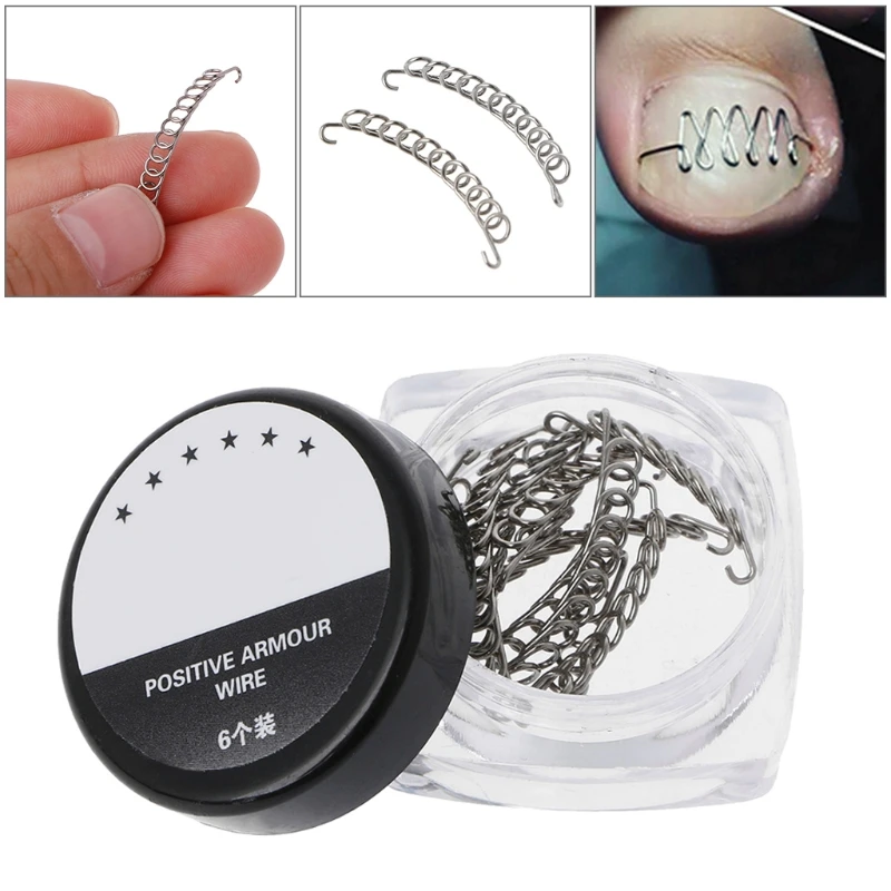 

Ingrown Toe Nail Correction Pedicure Wire Fixer Paronychia Recover Tool Home
