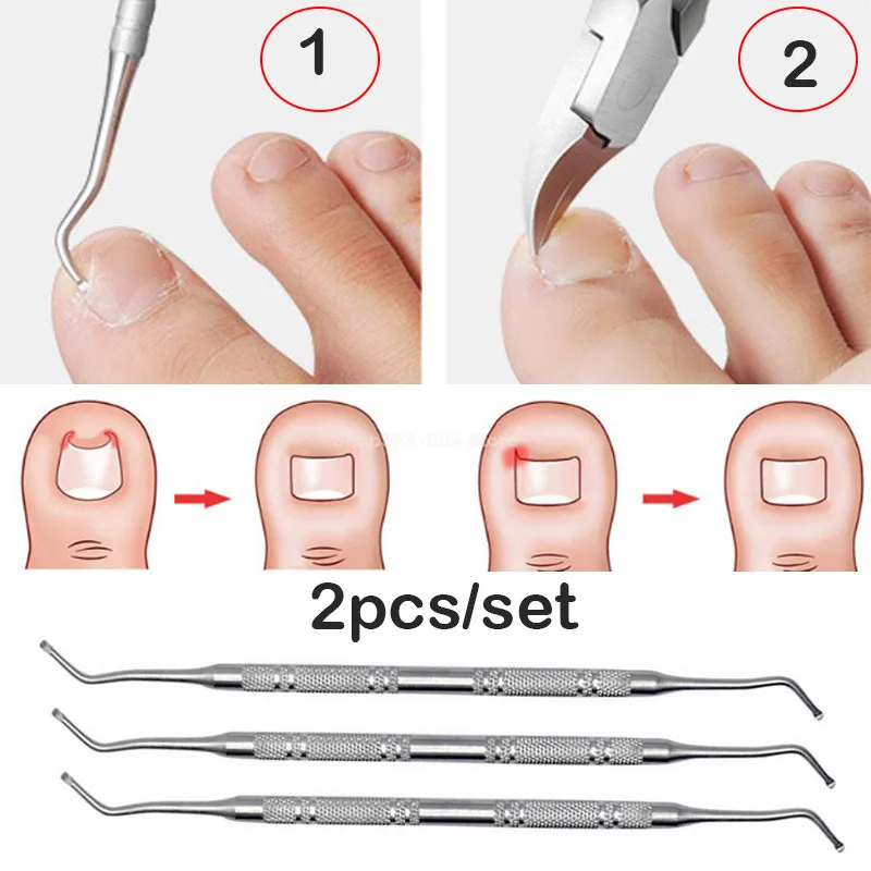 

2Pc/Set Ingrown Foot Care Tool Toe Nail Correction Nippers Clipper Cutters Dead Skin Dirt Remover + Paronychia Podiatry Pedicure