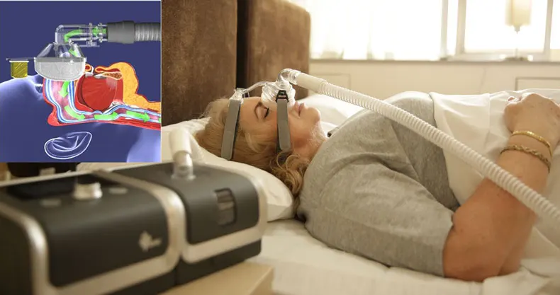 Máquina para Anti-noring Apnéia do Sono e Ronco com Umidificador Vitória Saudável Apap Máscara Mangueira Cartão sd Presente Como Spo2 Kit Gii 5 High Quality Beleza e saúde