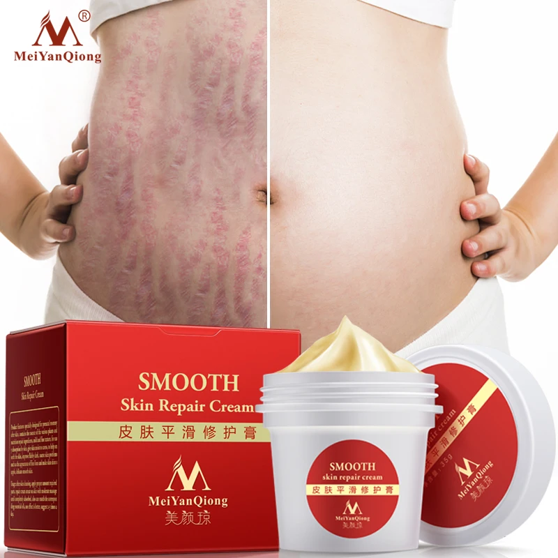 Meiyanqiong Гладкий крем для кожи для растяжек удаление шрамов для беременных ремонт кожи крем для тела крем от прыщей уход послеродовой