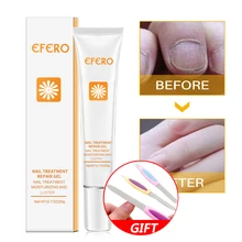 5 шт. EFERO средство для ухода за ногтями для ног грибок ногтей защитное покрытие для маникюра для удаления кутикулы Уход за кожей ногтей восстанавливающий крем