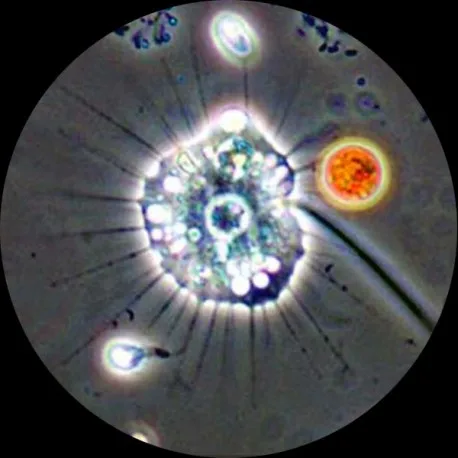 heliozoapc-microscope