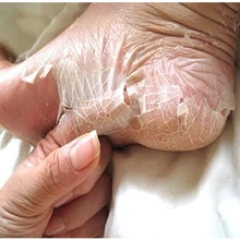 Putimi 2 шт. 1 пакет ноги маска педикюр носки для пилинга отшелушивающая маска для ног носки Spa стопы удаление ороговевшей кожи по уходу за ногами кожу ребенка