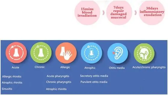 Новый продукт здравоохранения аллергического ринита устройства с низким уровнем лазерная терапия домашнего ухода appratus