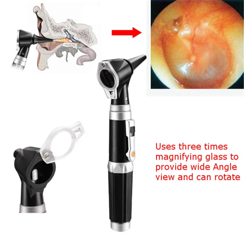 Профессиональная диагностическая Otoscope волоконно-оптическая медицинская широкая полевая Диагностика уха