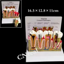 1 pc Dental Detachable Teeth Anatomical Model with Illustration and Base for Tooth Education and Anatomy 1 pc Dental Detachable Teeth Anatomical Model with Illustration and Base for Tooth Education and Anatomy