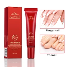 1 шт. травяное Лечение ногтей onychomicosis Paronychia против грибковой инфекции ногтей хороший результат Китайский травяной крем для ногтей