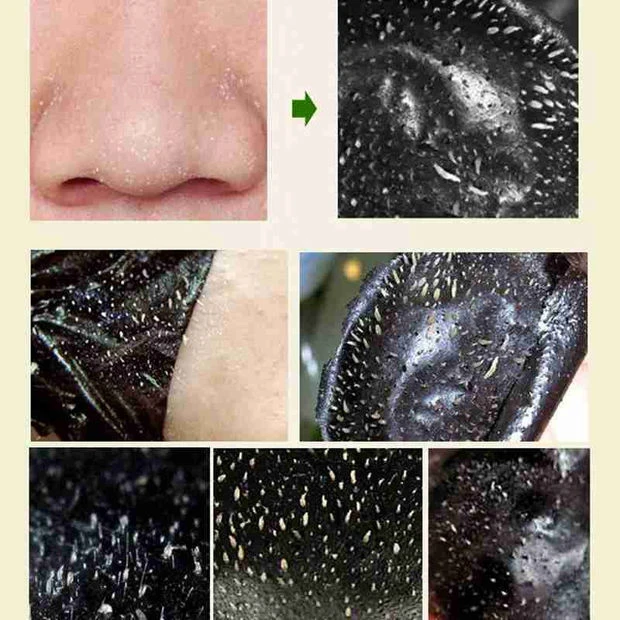 Value Pack Deep Cleansing Blackhead Removing Skin Purifying Face Peel Black Mask