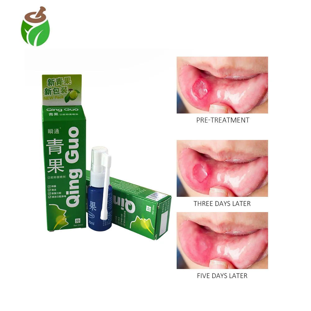 

2 Packs Herbal Mouth Freshener Antibacterial Oral Spray Treatment ulcers toothache Bad breath cleaning mouth odo Oral gum damage