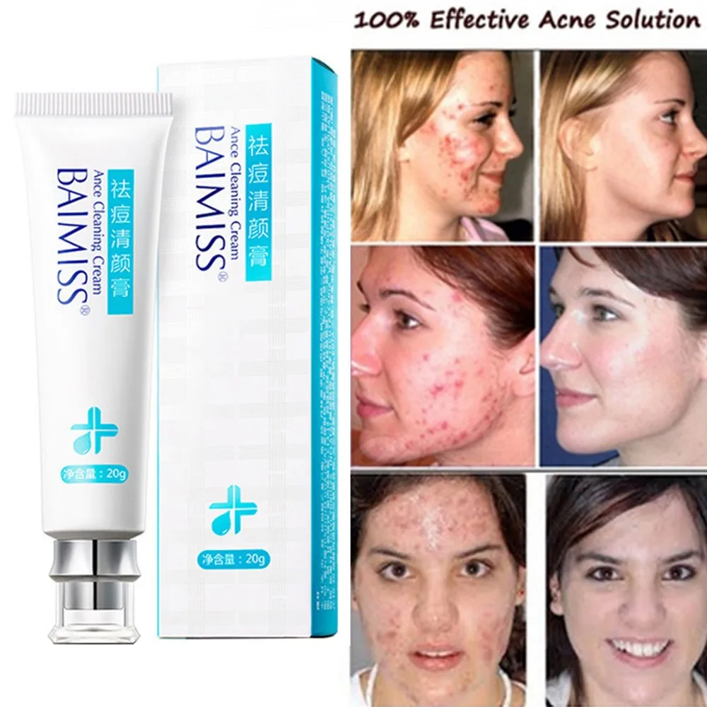 Repair Acne крем против акне Лечение пятен от шрам угрей усадка пор уход за кожей лица