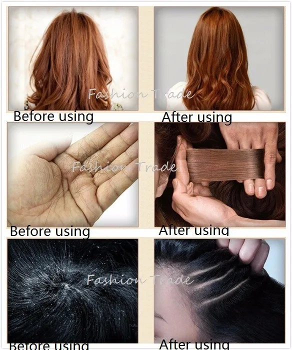Ginger Professional Hair Regrowth Shampoo And Conditioner 300ml Natural Shampoo for Hair growth Fast Thicker Hair Loss Product Ginger Professional Hair Regrowth Shampoo And Conditioner 300ml Natural Shampoo for Hair growth Fast Thicker Hair Loss Product