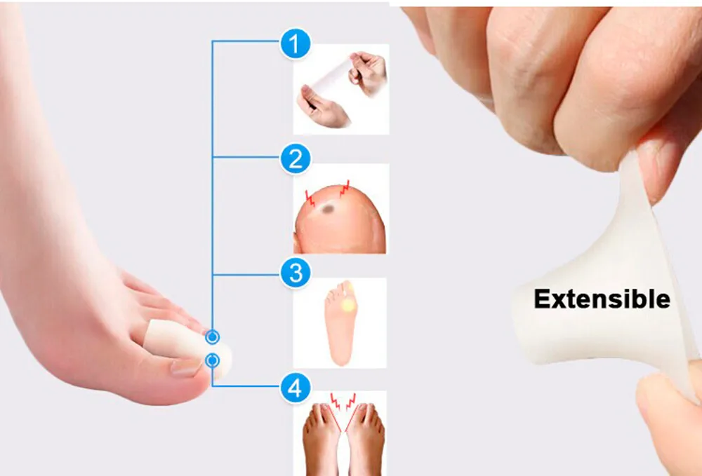 10 шт. пробки для ног волдыри гель для удаления трубчатый бондаж пальцев и пальцев протекторы от боли в ногах защита для ухода за ногами C169
