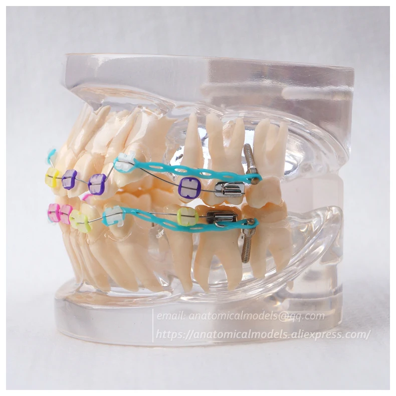 13025 DH202-3 Ortho Ceramic Bracket 2 