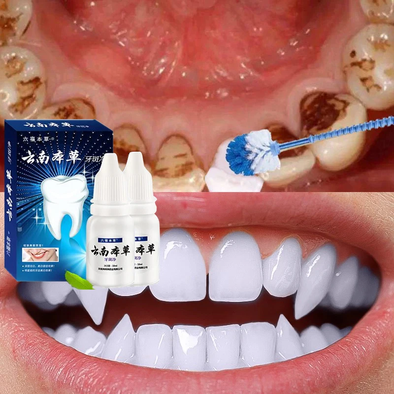 

2pcs Herb Teeth Whitening Essence Oral Cleansing Oral Hygiene Serum Effectively Removes Tartars Plaque Stains Dental Tools Care