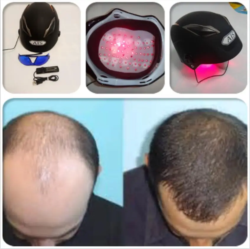 64 soft lasers scalp exerciser cap helmet+glasses+timer+massage comb