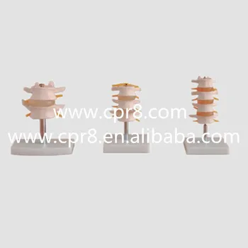 

BIX-A1010 Normal Lumbar Skeleton Set 2pcs 3pcs 4pcs Vertebrae Model MQ208
