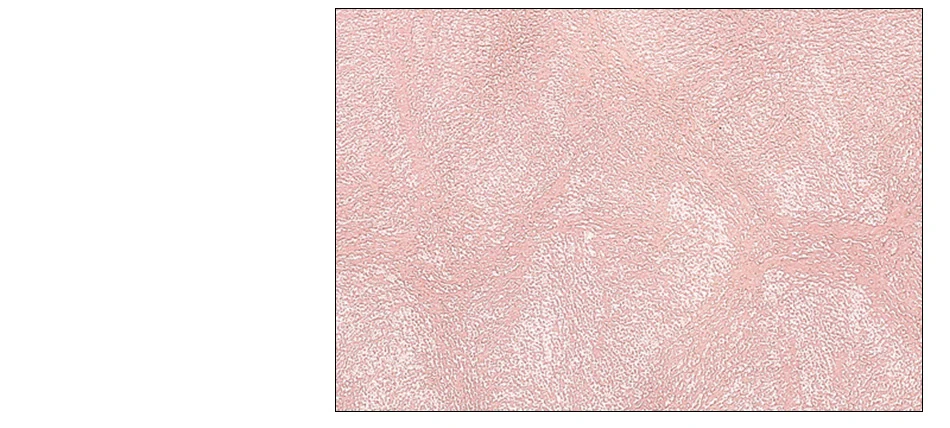  (3)