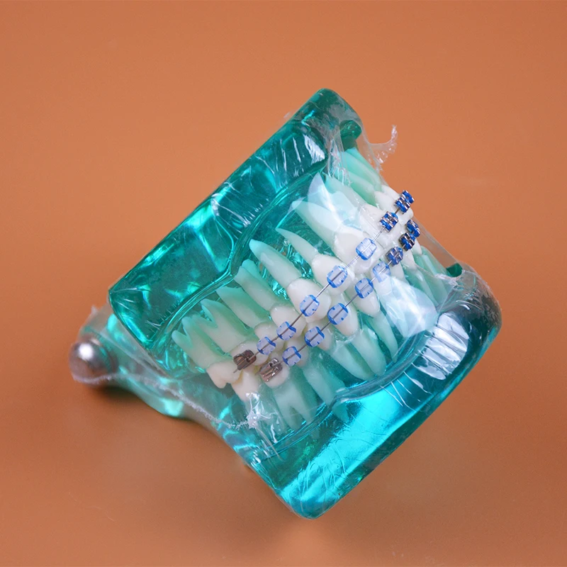  B7-02 Orthodontics Malocclusion Braces Dental Acrylic Teeth Dental Teaching Model Ortho Metal & Cer - 32626113795