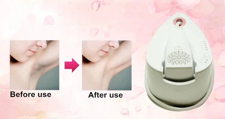 Hair removal machine7