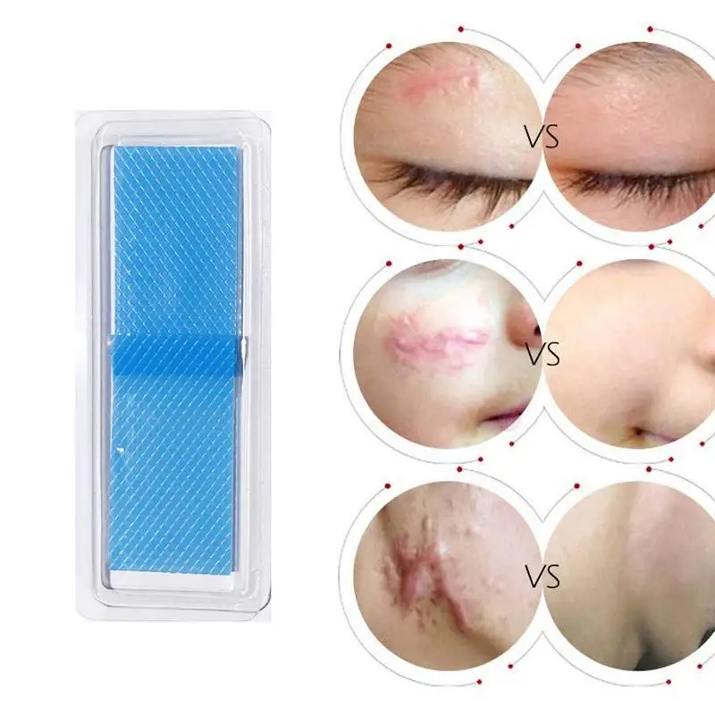 

Efficient Caesarean Section Surgery Silicone Gel Removal Scar Sheet Therapy Patch For Acne Trauma Burn Scar Skin Repair Patch