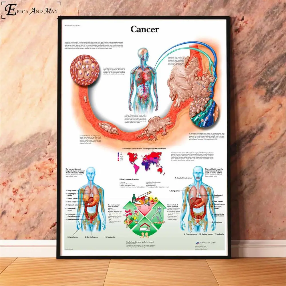 Анатомия болезни патологии диаграмма картина, печатный плакат декоративные настенные картины для комнаты без рамки украшения дома аксессуары - Цвет: Cancer