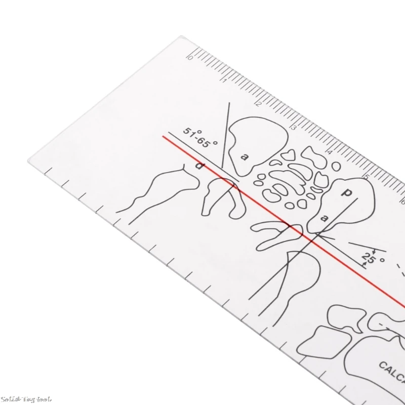 Goniometer Medical Ruler Rule Joint Orthopedics Tool Instruments Plastic 4XFD