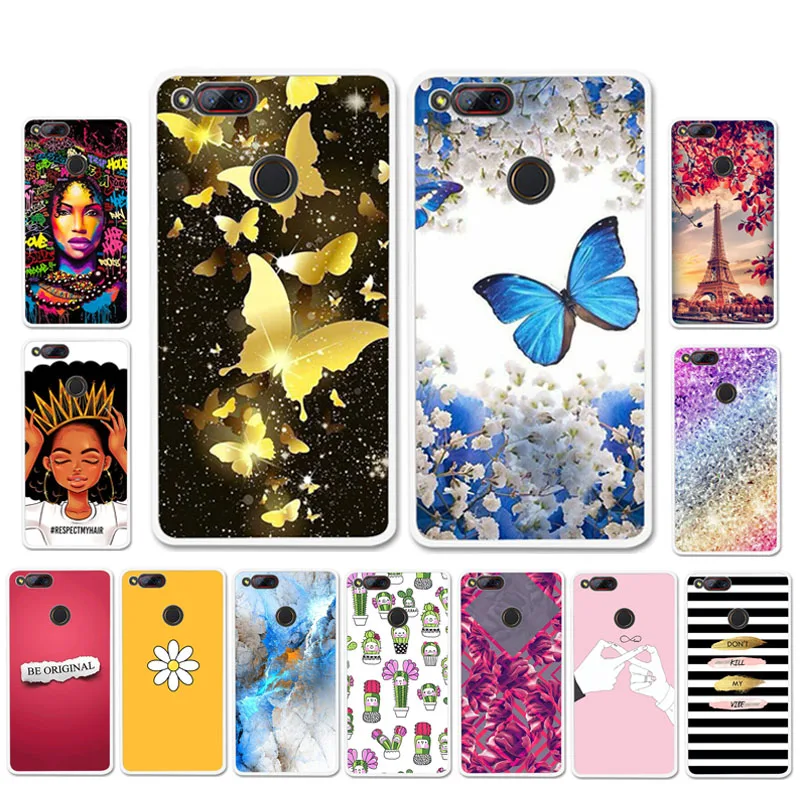 

Ojeleye DIY Patterned Silicon Case For ZTE Nubia Z17 Mini Case Soft TPU Cartoon Cover For ZTE Z17 Mini Covers Anti-knock Shell