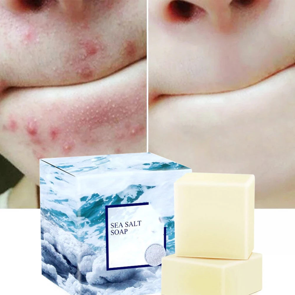 

Hot Sale Sea Salt Soap Goat Milk Remove Acne Oil-Control Clean Skin Shrinks Pores Sulphur Soap