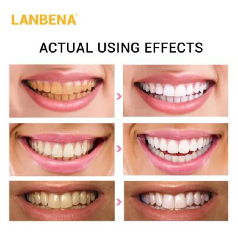 Полоски для отбеливания зубов LANBENA ежедневное использование гигиена полости рта