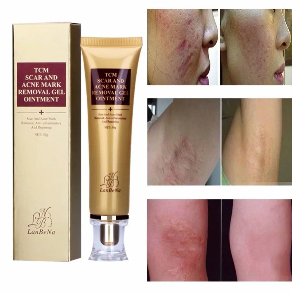 tcm scar and acne removal gel ointment